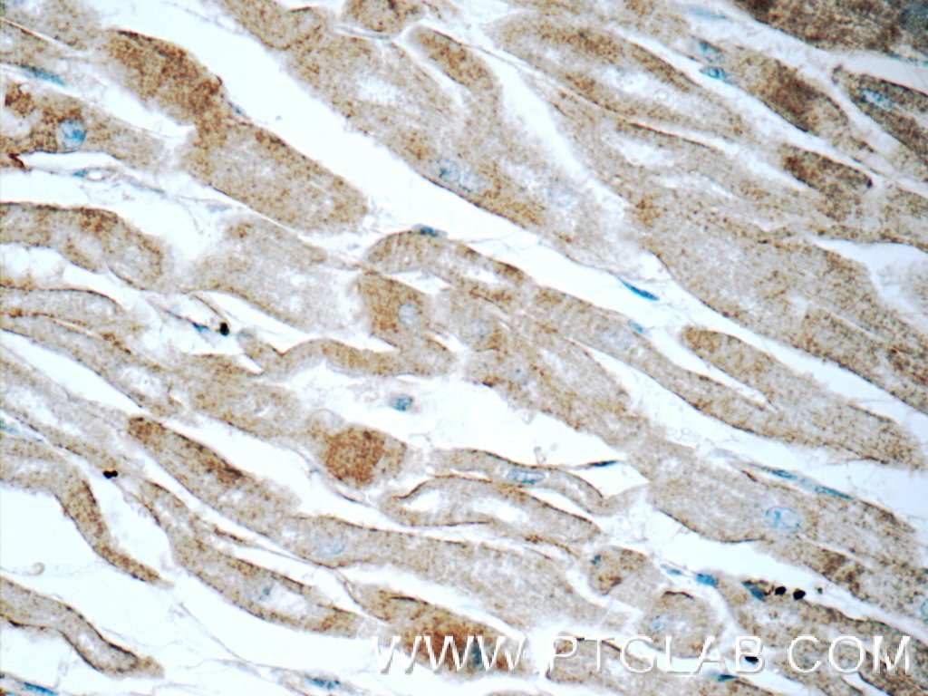 Immunohistochemistry (IHC) staining of human heart tissue using Cadherin-13 Polyclonal antibody (12618-1-AP)