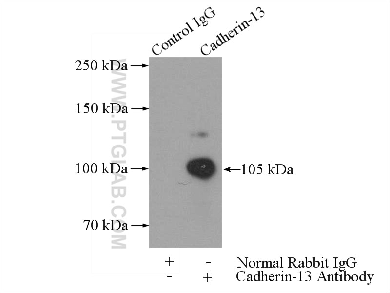 Immunoprecipitation (IP) experiment of mouse heart tissue using Cadherin-13 Polyclonal antibody (12618-1-AP)