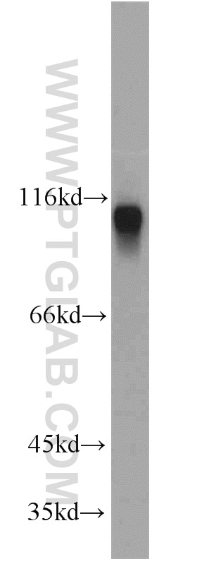 Western Blot (WB) analysis of human heart tissue using Cadherin-13 Polyclonal antibody (12618-1-AP)