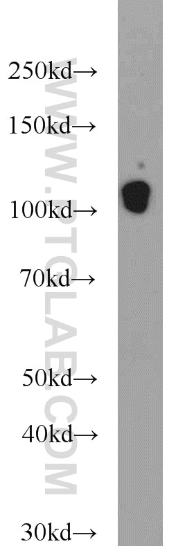 Western Blot (WB) analysis of mouse heart tissue using Cadherin-13 Polyclonal antibody (12618-1-AP)