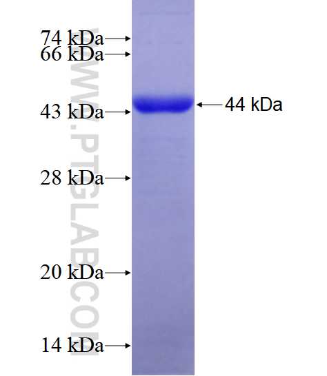 CDH13 fusion protein Ag28572 SDS-PAGE