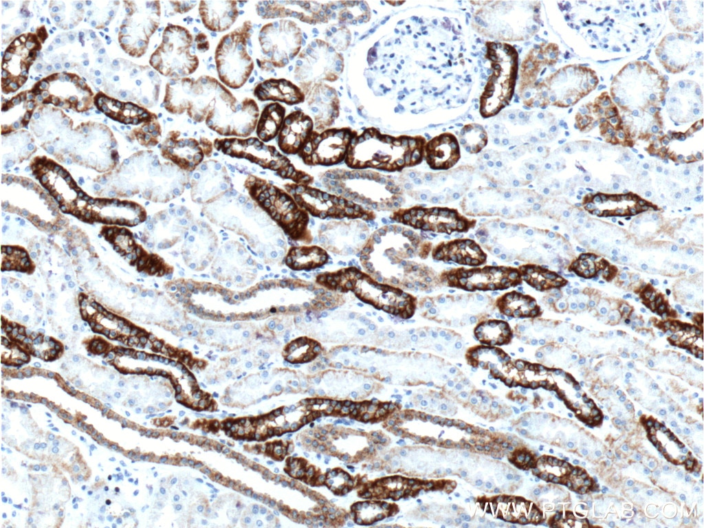 Immunohistochemistry (IHC) staining of human kidney tissue using Cadherin-16 Polyclonal antibody (15107-1-AP)