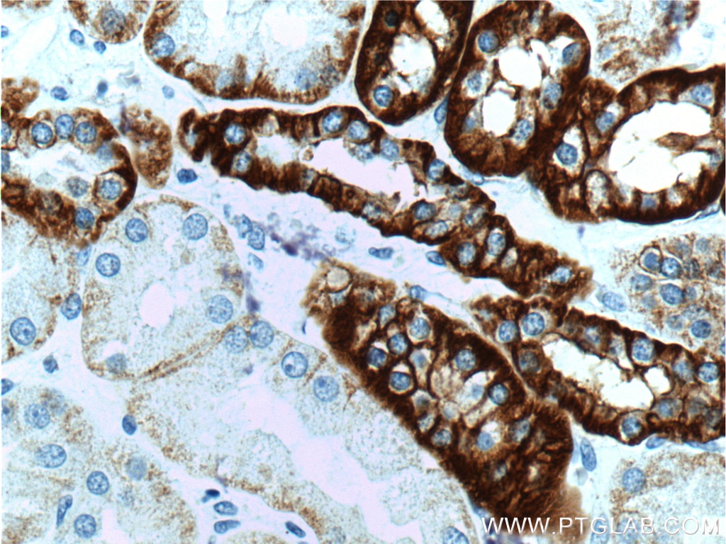 IHC staining of human kidney using 15107-1-AP