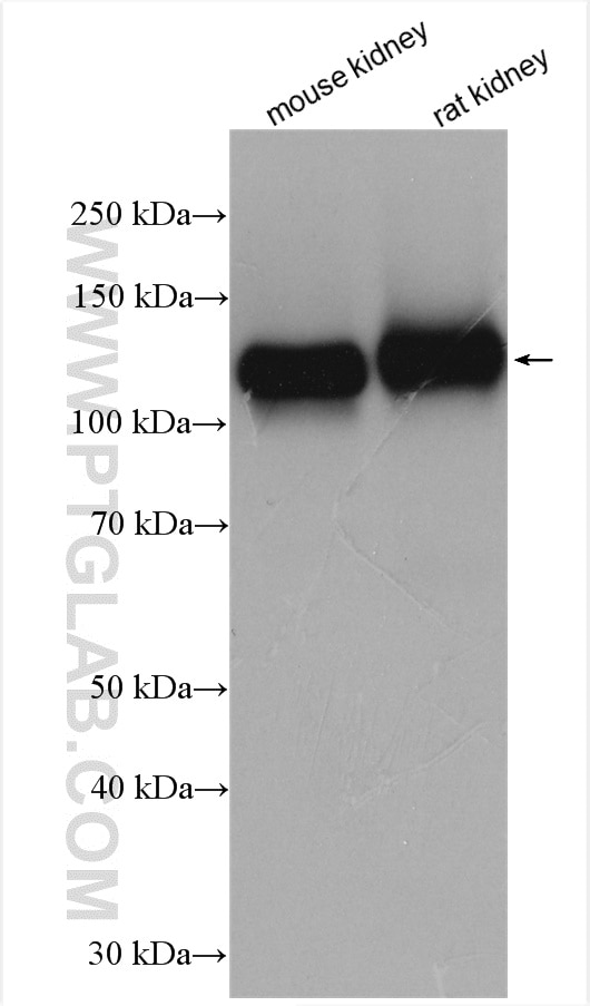 Western Blot (WB) analysis of various lysates using Cadherin-16 Polyclonal antibody (15107-1-AP)