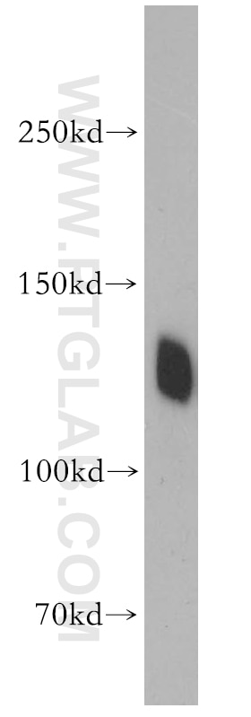 Western Blot (WB) analysis of mouse kidney tissue using Cadherin-16 Polyclonal antibody (15107-1-AP)