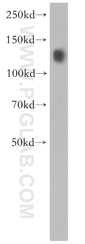 Western Blot (WB) analysis of human kidney tissue using Cadherin-16 Polyclonal antibody (15107-1-AP)