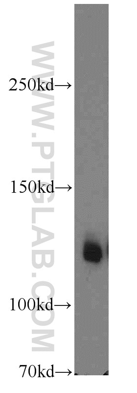 Western Blot (WB) analysis of HEK-293 cells using Cadherin-16 Polyclonal antibody (15107-1-AP)