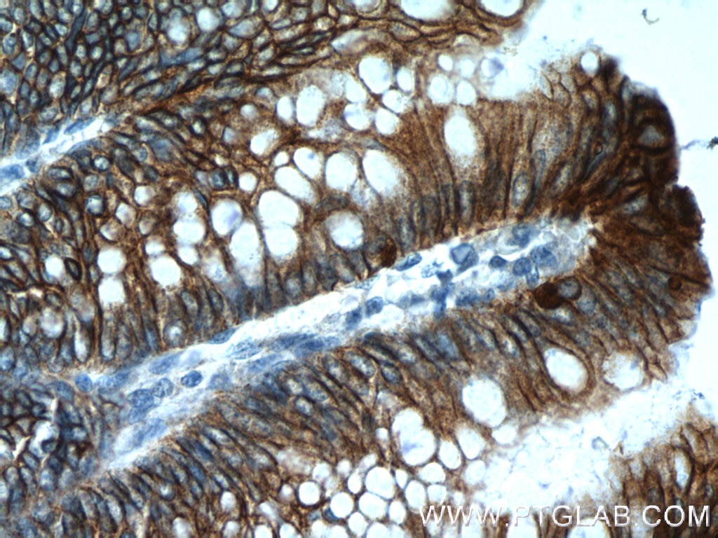 IHC staining of human colon using 24339-1-AP