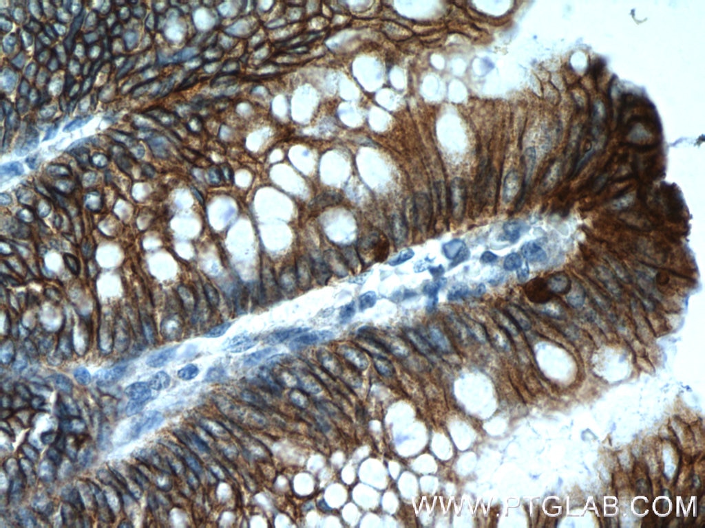 Immunohistochemistry (IHC) staining of human colon tissue using Cadherin-17 Polyclonal antibody (24339-1-AP)