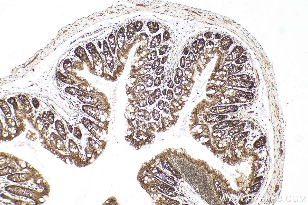 Immunohistochemistry (IHC) staining of mouse colon tissue using Cadherin-17 Polyclonal antibody (24339-1-AP)