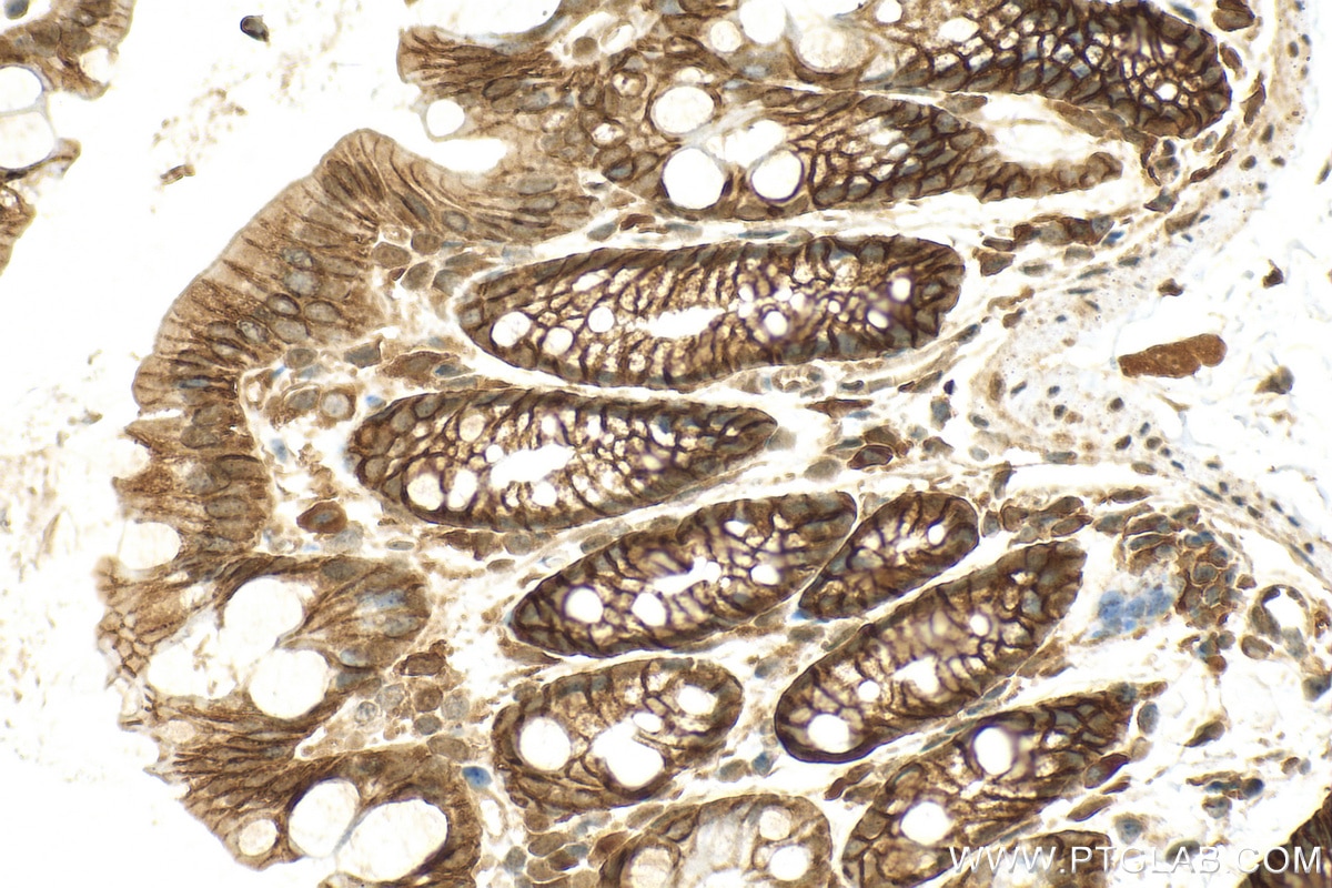 Immunohistochemistry (IHC) staining of mouse colon tissue using Cadherin-17 Polyclonal antibody (24339-1-AP)