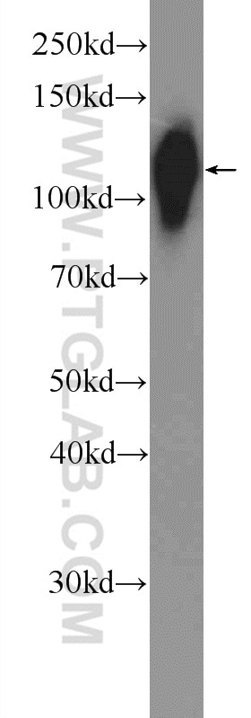 WB analysis of mouse small intestine using 24339-1-AP