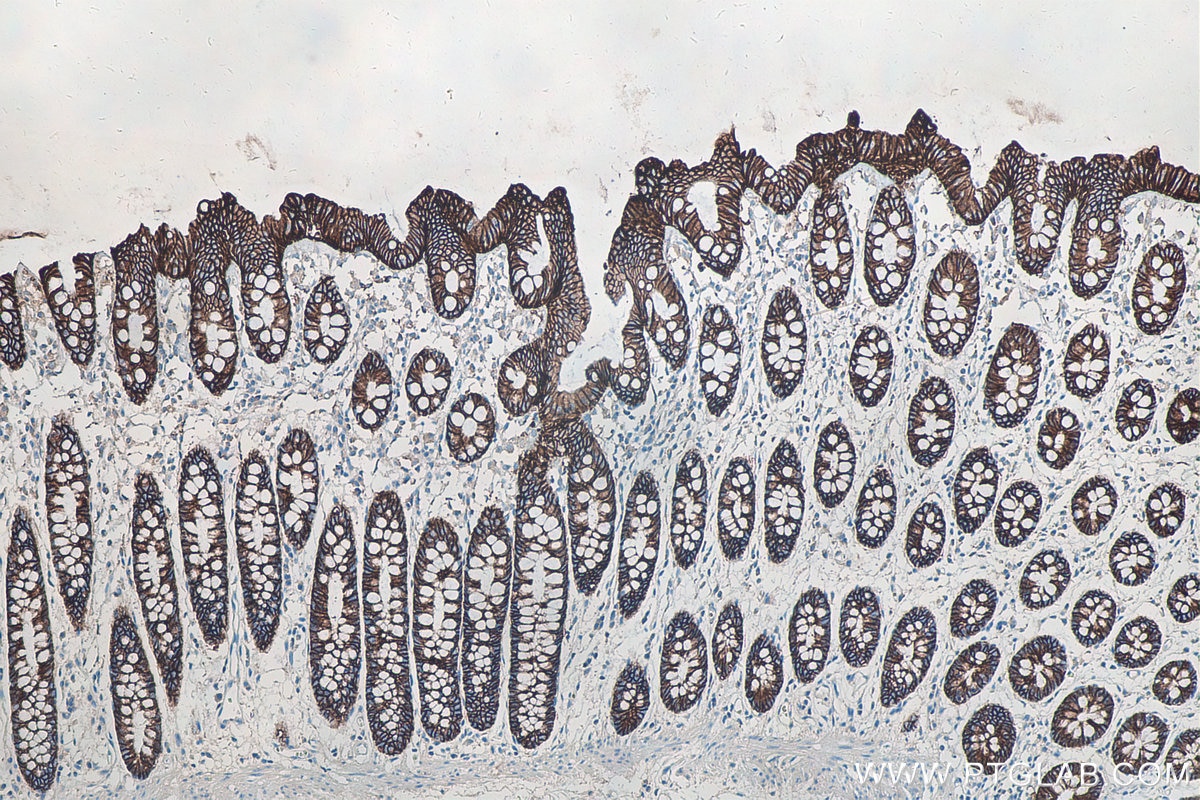 Immunohistochemistry (IHC) staining of human colon tissue using Cadherin-17 Monoclonal antibody (60351-1-Ig)
