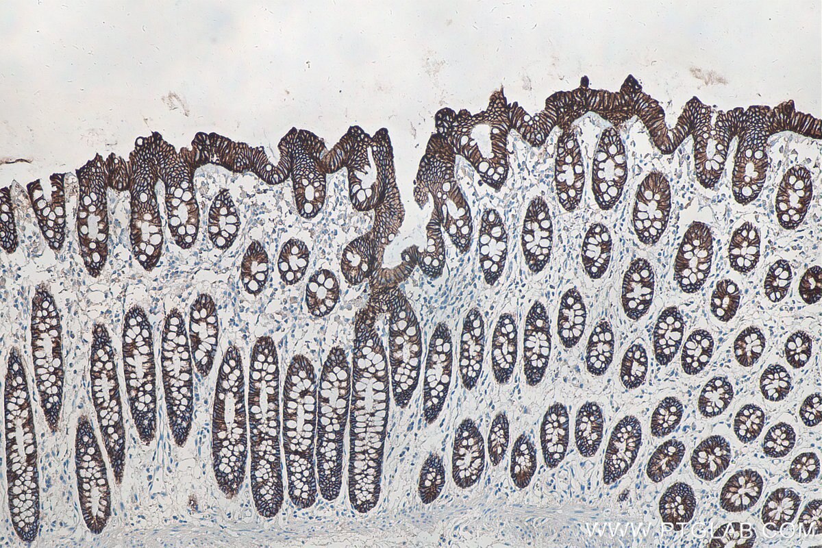 IHC staining of human colon using 60351-1-Ig