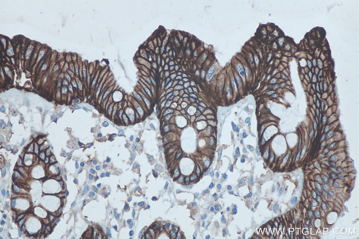 Immunohistochemistry (IHC) staining of human colon tissue using Cadherin-17 Monoclonal antibody (60351-1-Ig)