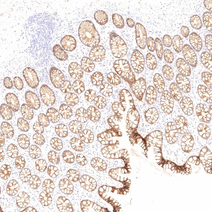 Immunohistochemistry (IHC) staining of human large intestine tissue using Cadherin-17 Monoclonal antibody (60351-1-Ig)