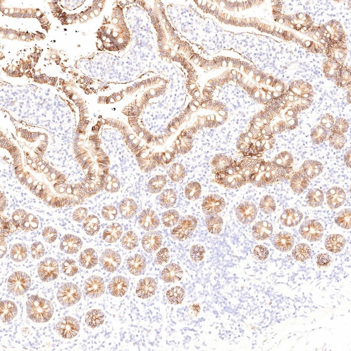 Immunohistochemistry (IHC) staining of human small intestine tissue using Cadherin-17 Monoclonal antibody (60351-1-Ig)