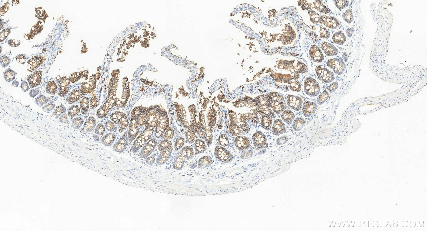 Immunohistochemistry (IHC) staining of rat small intestine tissue using Cadherin-17 Monoclonal antibody (60351-1-Ig)