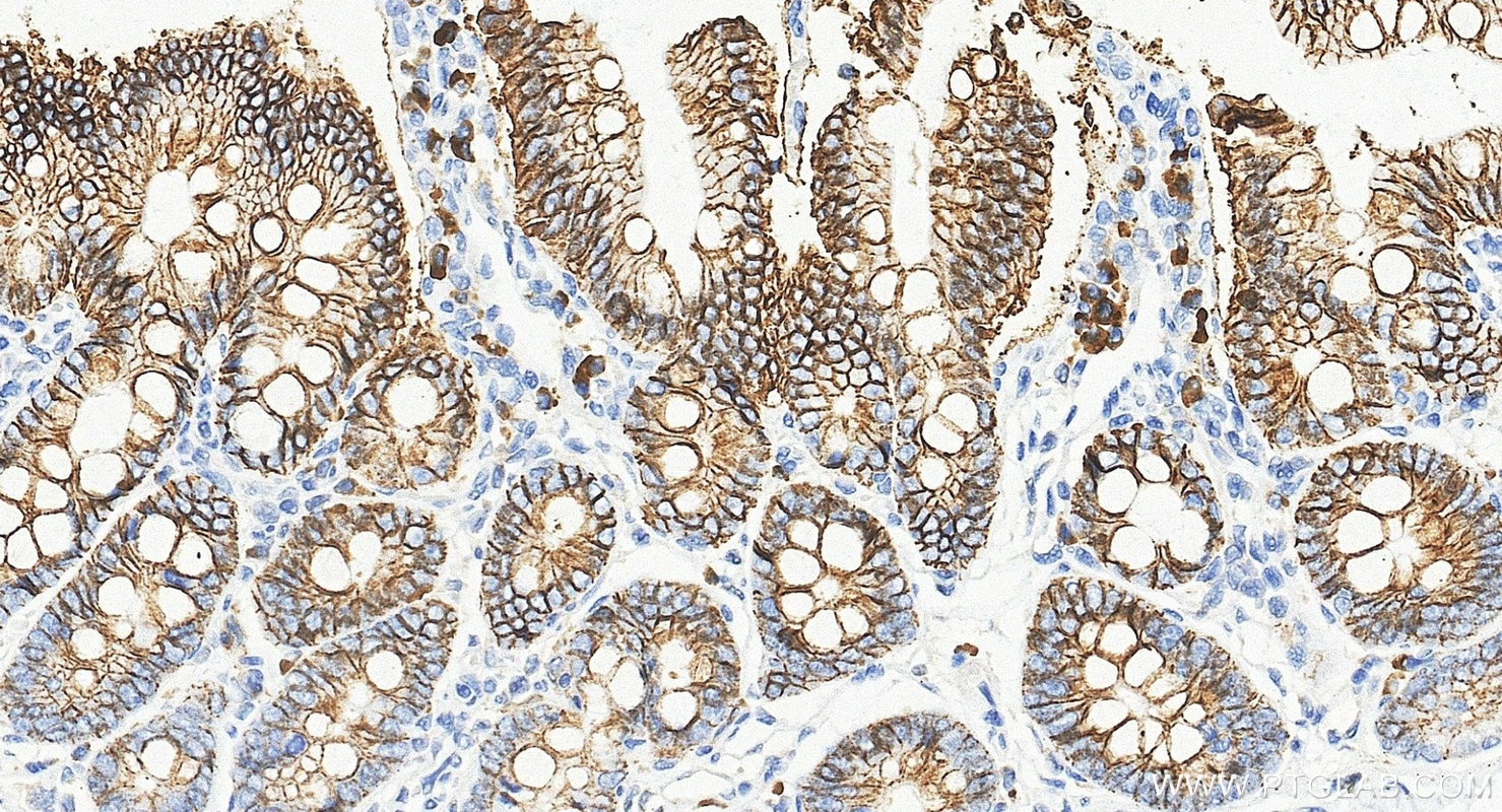 Immunohistochemistry (IHC) staining of rat small intestine tissue using Cadherin-17 Monoclonal antibody (60351-1-Ig)
