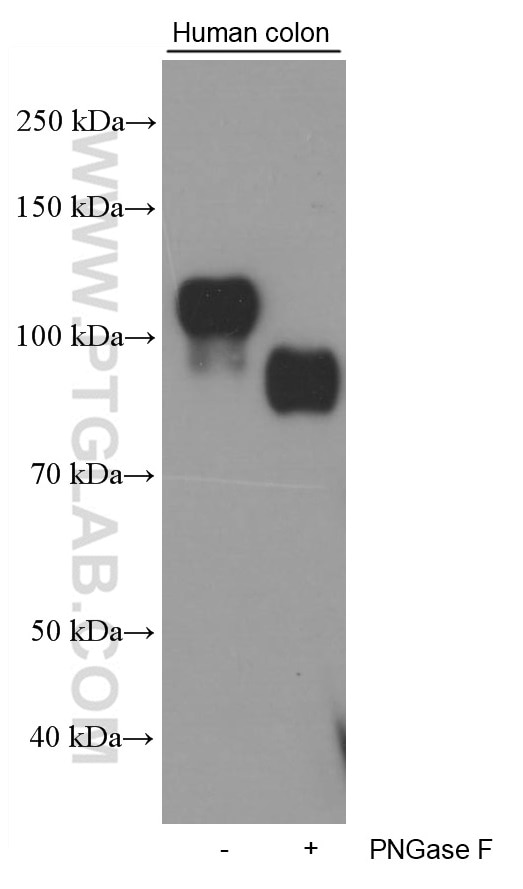 Western Blot (WB) analysis of human colon tissue using Cadherin-17 Monoclonal antibody (60351-1-Ig)