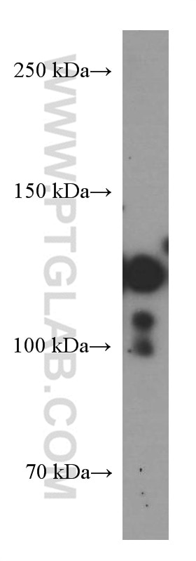 Western Blot (WB) analysis of pig colon tissue using Cadherin-17 Monoclonal antibody (60351-1-Ig)