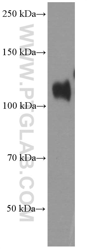 Western Blot (WB) analysis of human colon tissue using Cadherin-17 Monoclonal antibody (60351-1-Ig)