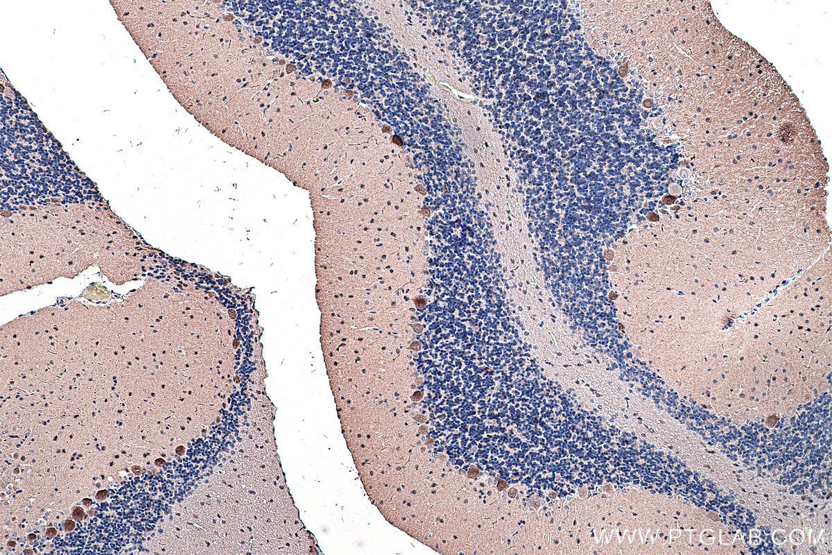 Immunohistochemistry (IHC) staining of rat cerebellum tissue using Cadherin-18 Polyclonal antibody (13091-1-AP)