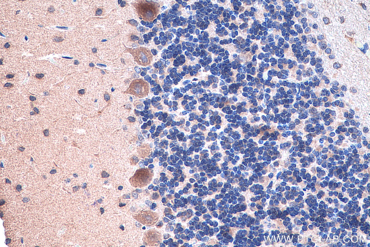 IHC staining of rat cerebellum using 13091-1-AP