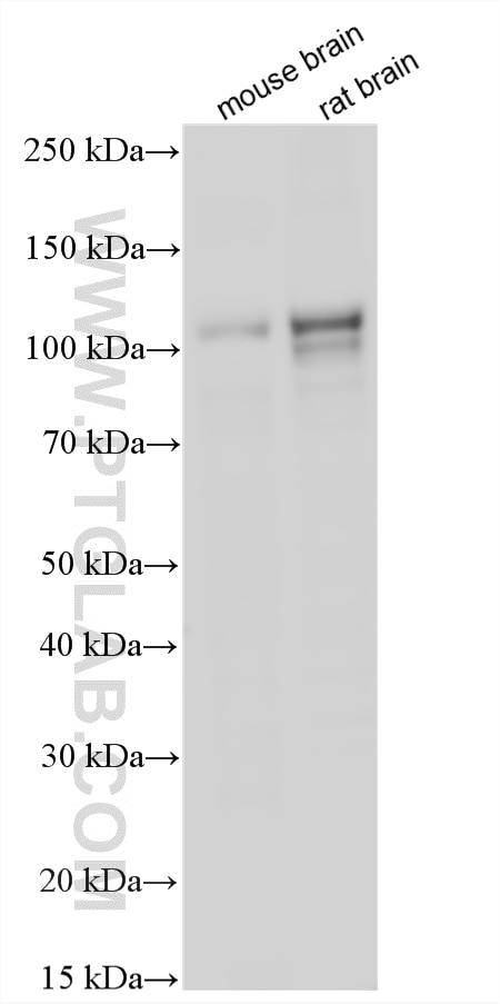 Western Blot (WB) analysis of various lysates using Cadherin-18 Polyclonal antibody (13091-1-AP)