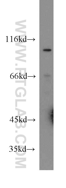 Western Blot (WB) analysis of COLO 320 cells using Cadherin-18 Polyclonal antibody (13091-1-AP)