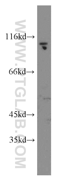 Western Blot (WB) analysis of A549 cells using Cadherin-18 Polyclonal antibody (13091-1-AP)