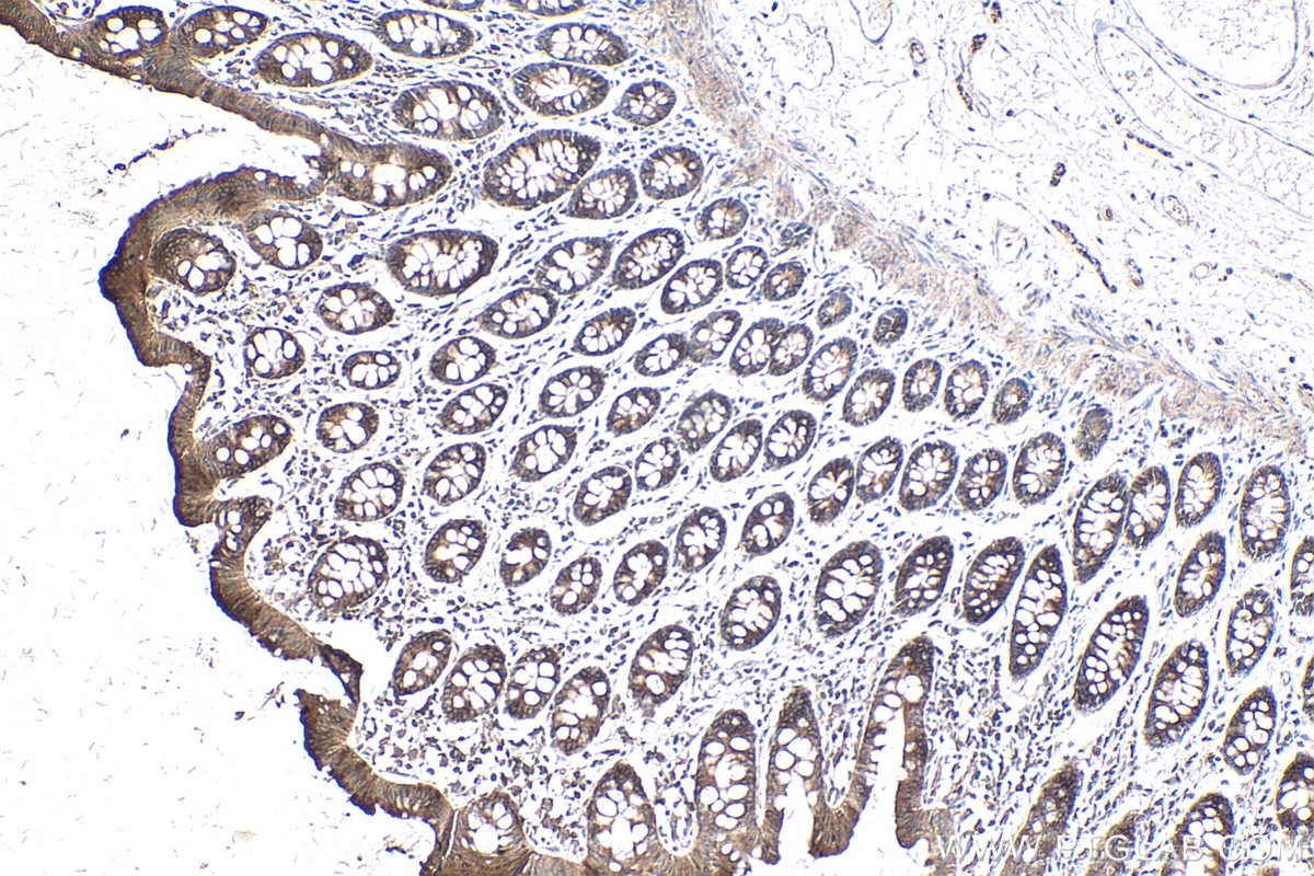 IHC staining of human colon using 22049-1-AP