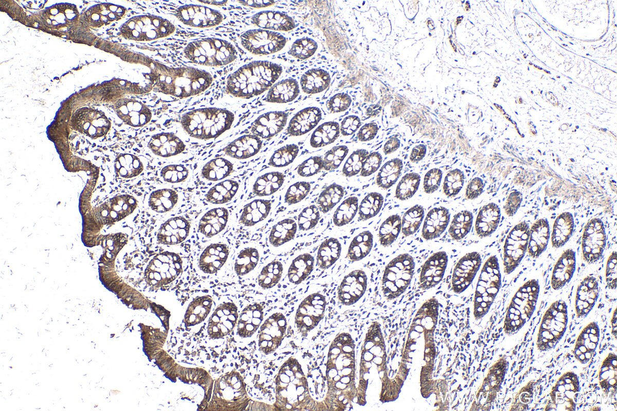 Immunohistochemistry (IHC) staining of human colon tissue using Cadherin-20 Polyclonal antibody (22049-1-AP)