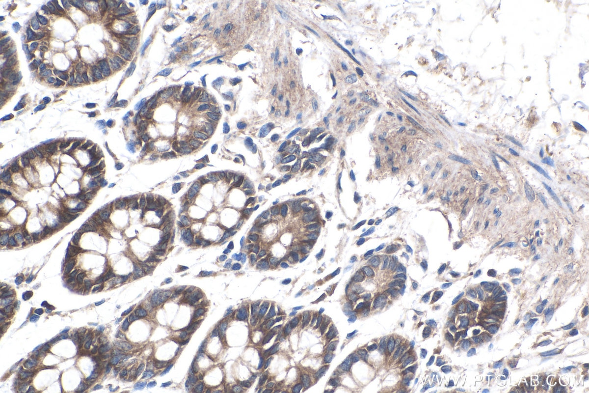 Immunohistochemistry (IHC) staining of human colon tissue using Cadherin-20 Polyclonal antibody (22049-1-AP)