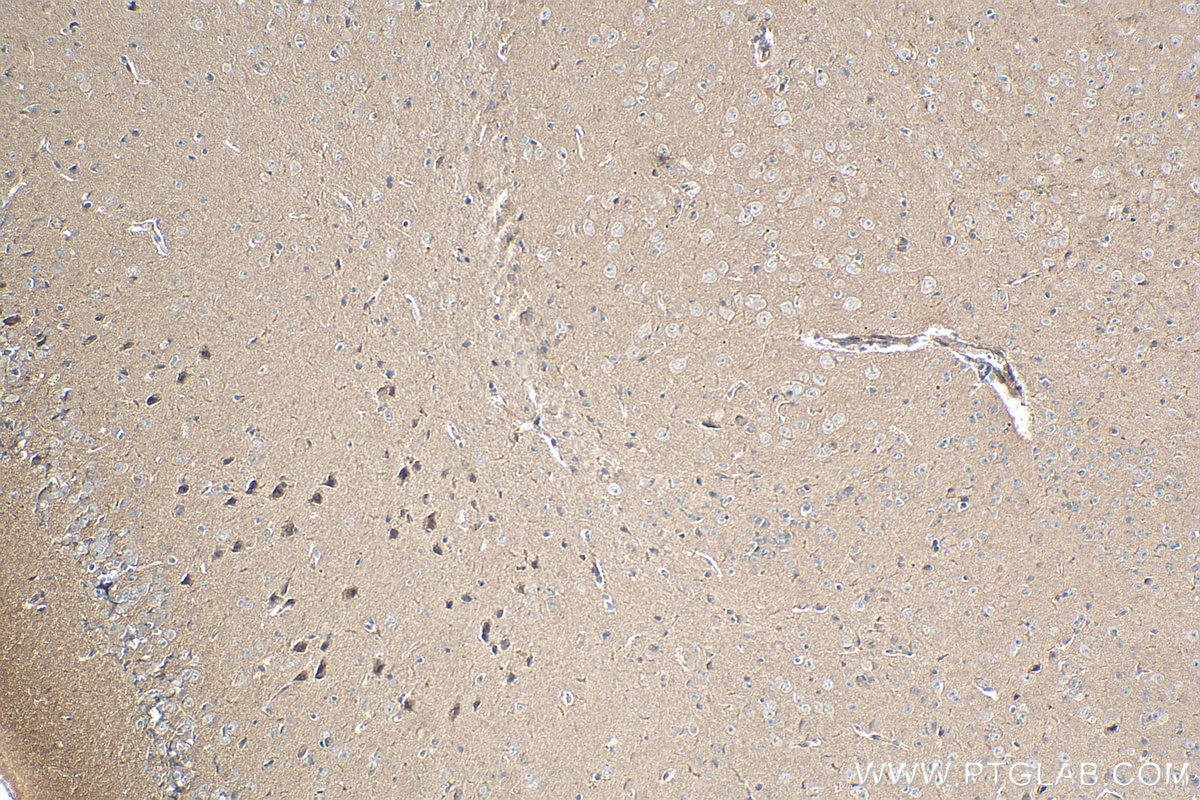 Immunohistochemistry (IHC) staining of mouse brain tissue using Cadherin-20 Polyclonal antibody (22049-1-AP)