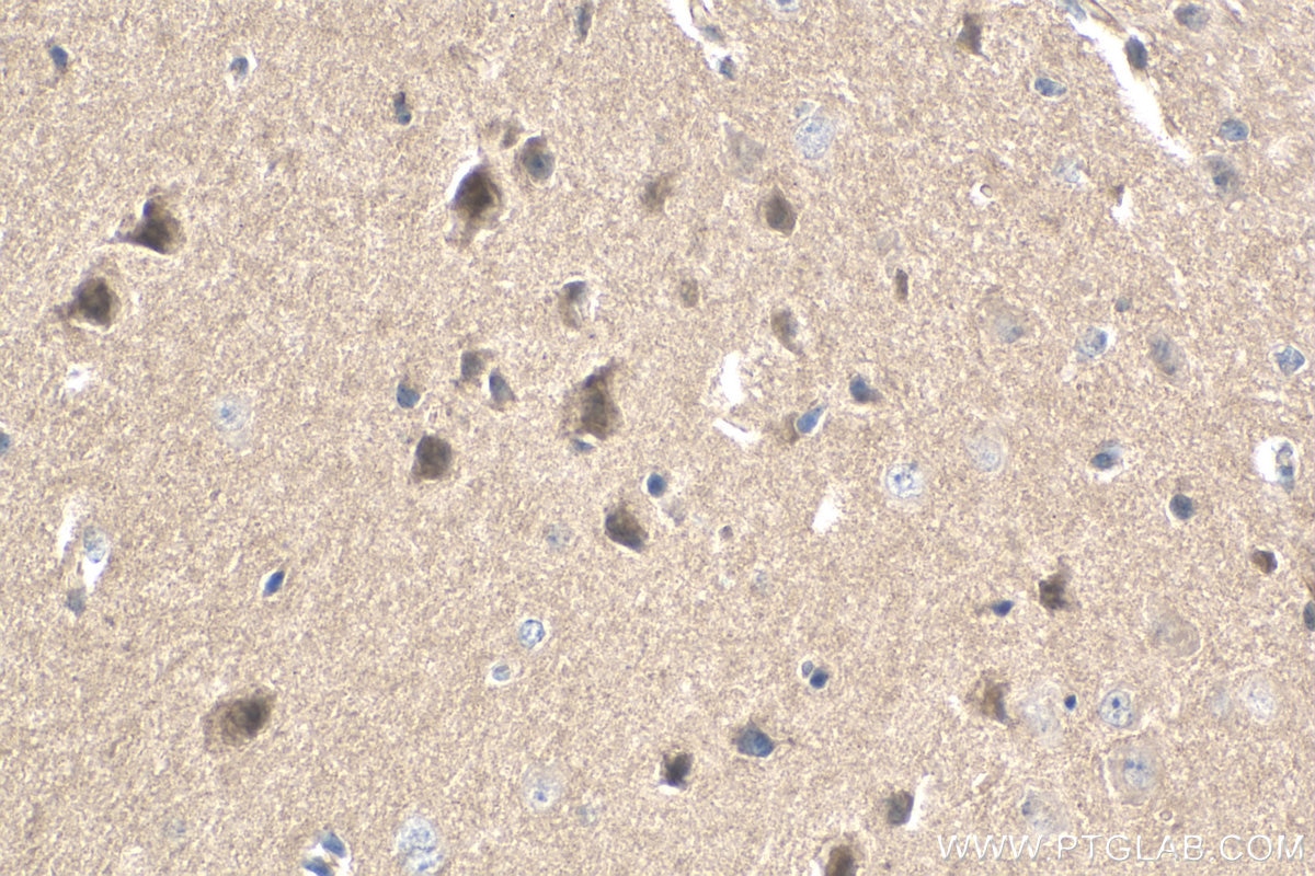 Immunohistochemistry (IHC) staining of mouse brain tissue using Cadherin-20 Polyclonal antibody (22049-1-AP)