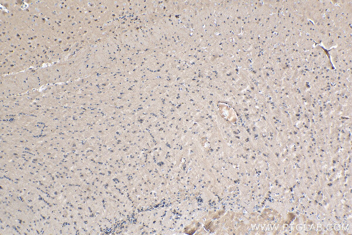 Immunohistochemistry (IHC) staining of rat brain tissue using Cadherin-20 Polyclonal antibody (22049-1-AP)