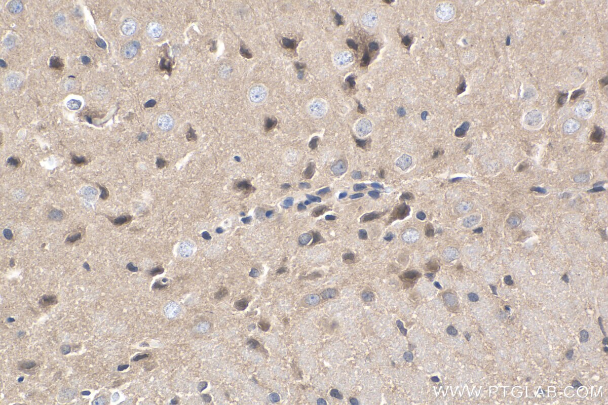 Immunohistochemistry (IHC) staining of rat brain tissue using Cadherin-20 Polyclonal antibody (22049-1-AP)