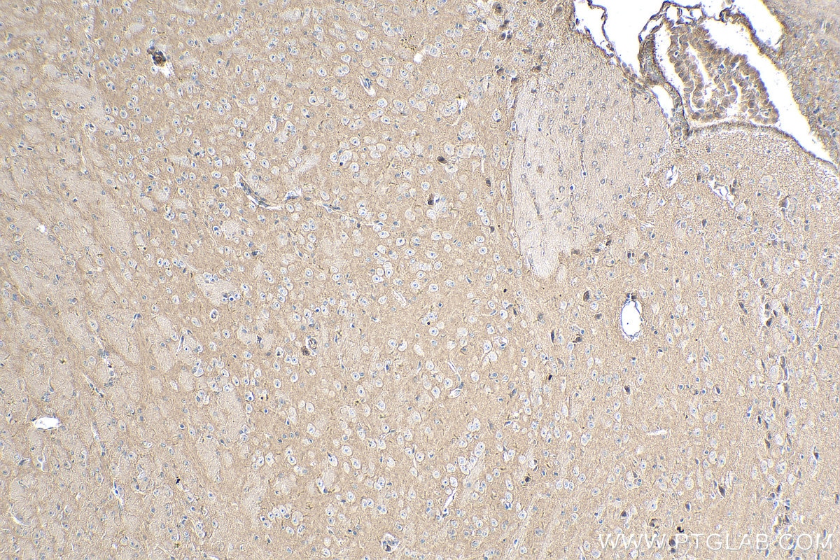 Immunohistochemistry (IHC) staining of mouse brain tissue using Cadherin-20 Polyclonal antibody (22049-1-AP)