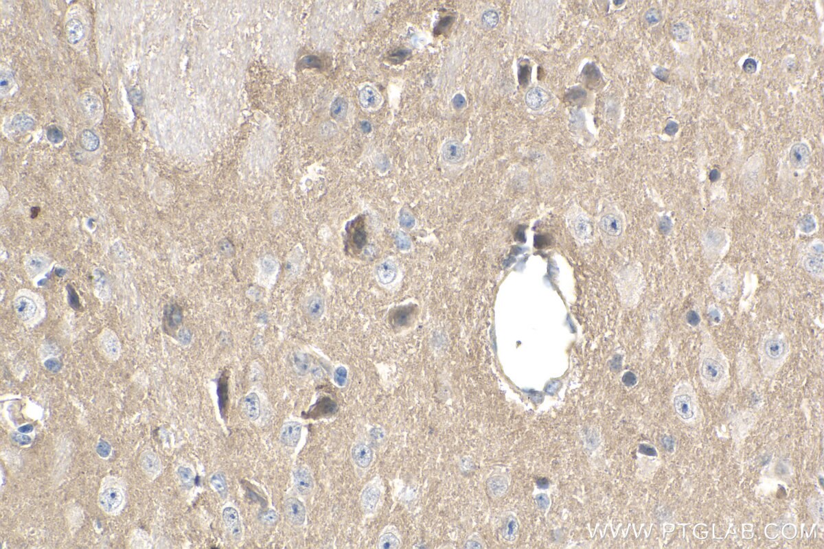Immunohistochemistry (IHC) staining of mouse brain tissue using Cadherin-20 Polyclonal antibody (22049-1-AP)