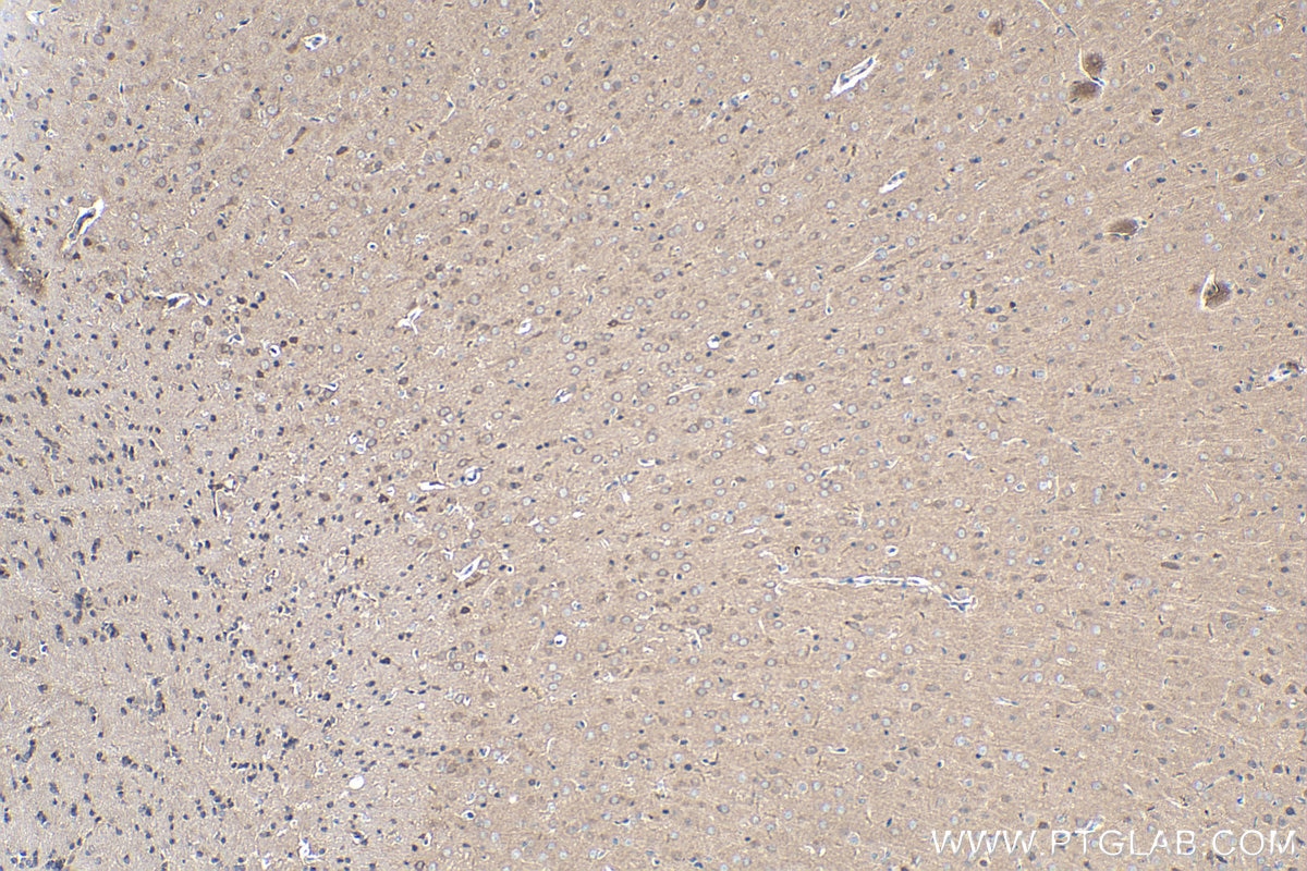 Immunohistochemistry (IHC) staining of rat brain tissue using Cadherin-20 Polyclonal antibody (22049-1-AP)