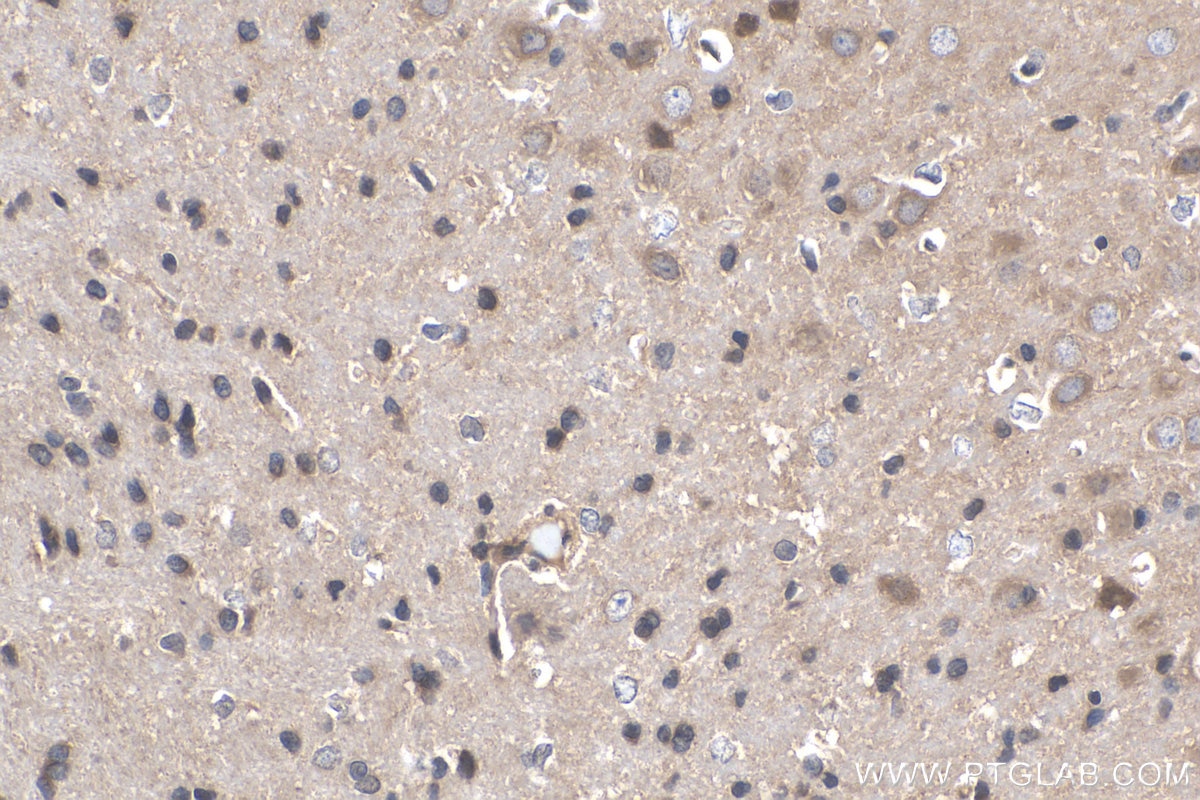 Immunohistochemistry (IHC) staining of rat brain tissue using Cadherin-20 Polyclonal antibody (22049-1-AP)