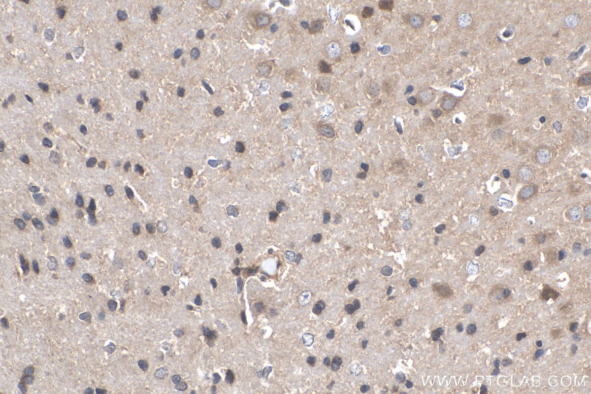 Immunohistochemistry (IHC) staining of rat brain tissue using Cadherin-20 Polyclonal antibody (22049-1-AP)