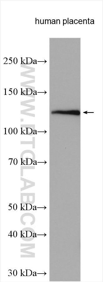 Western Blot (WB) analysis of various lysates using Cadherin-20 Polyclonal antibody (22049-1-AP)