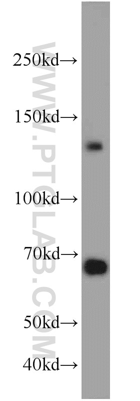 Western Blot (WB) analysis of HeLa cells using Cadherin-20 Polyclonal antibody (22049-1-AP)
