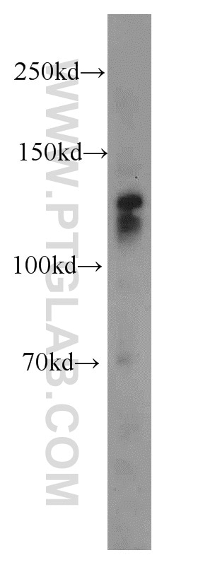 Western Blot (WB) analysis of mouse brain tissue using Cadherin-20 Polyclonal antibody (22049-1-AP)