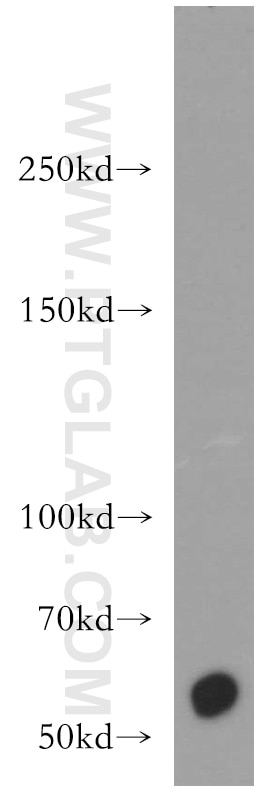 Western Blot (WB) analysis of A431 cells using CDH23 Polyclonal antibody (13496-1-AP)