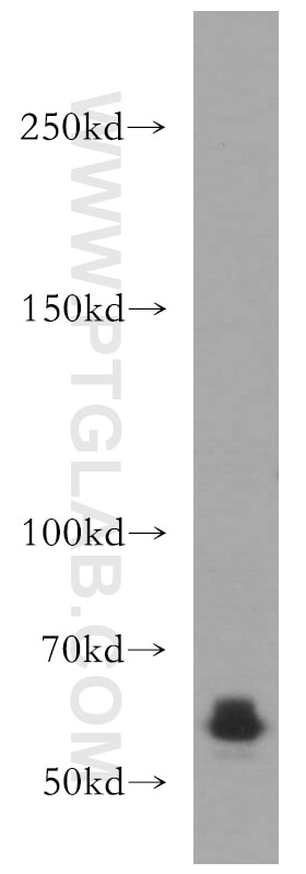 Western Blot (WB) analysis of Y79 cells using CDH23 Polyclonal antibody (13496-1-AP)