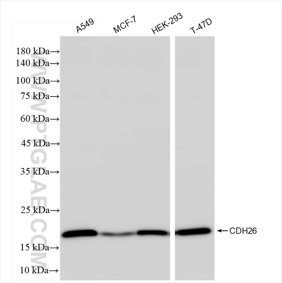 Western Blot (WB) analysis of various lysates using CDH26 Recombinant antibody (84143-1-RR)