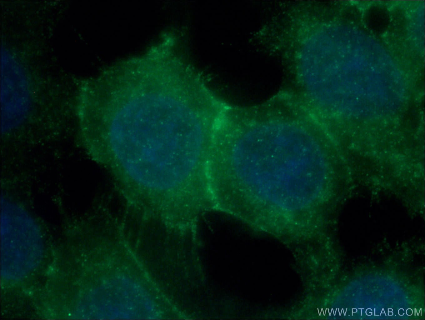 Immunofluorescence (IF) / fluorescent staining of A431 cells using P-cadherin Polyclonal antibody (13773-1-AP)